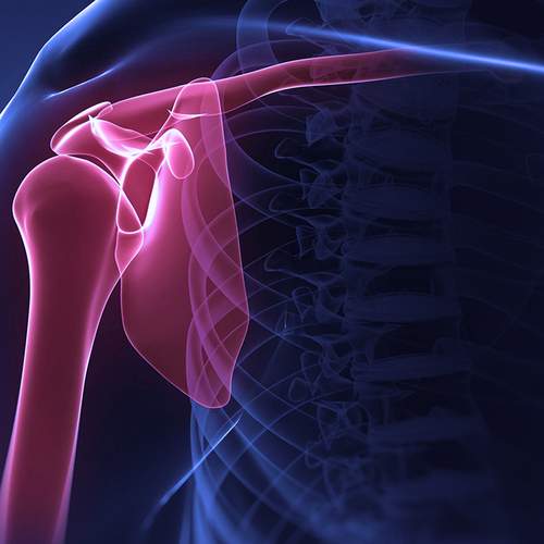 Курс по магнитно-резонансной томографии в диагностике повреждений плечевого сустава.