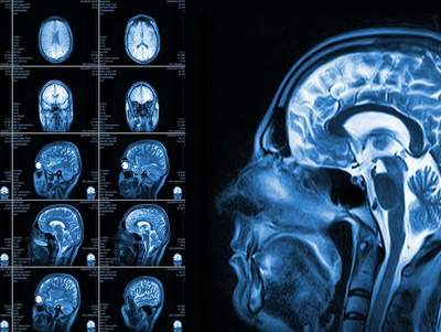 Базовый курс по МРТ: основы метода и введение в нейрорадиологию