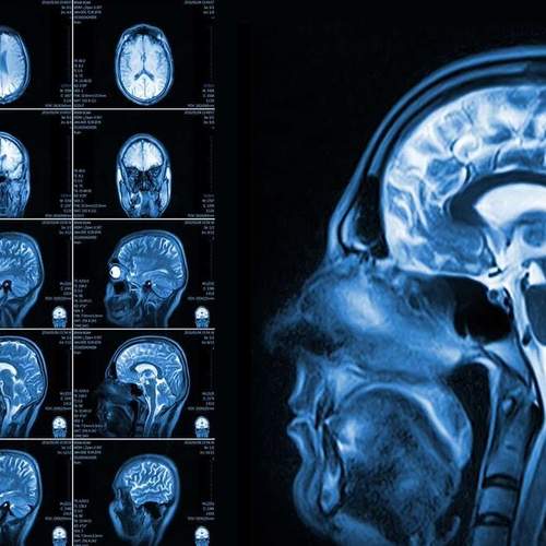 Базовый курс по МРТ: основы метода и введение в нейрорадиологию