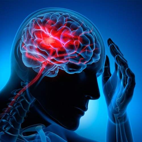Курс по лучевой диагностике сосудистых заболеваний головного мозга и нарушений мозгового кровообращения.